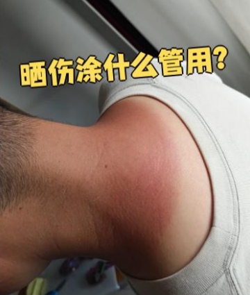 晒后泛红发烫？一杯温凉茶水，舒缓修护超实用-茶之家